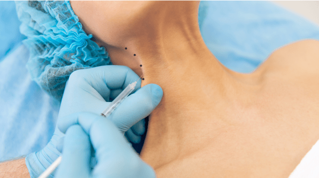 Neuromodulateurs niveau 3