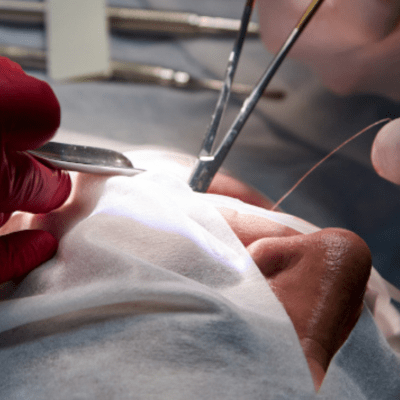 formation spécialisée en chirurgie buccale et maxillo-faciale